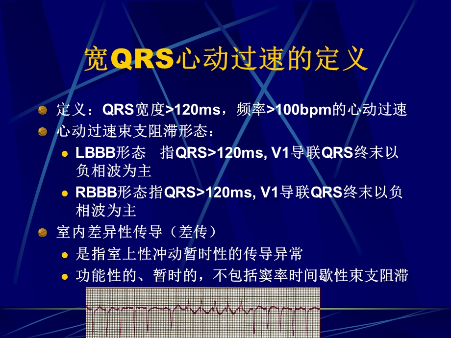 宽QRS波群心动过速.ppt_第2页