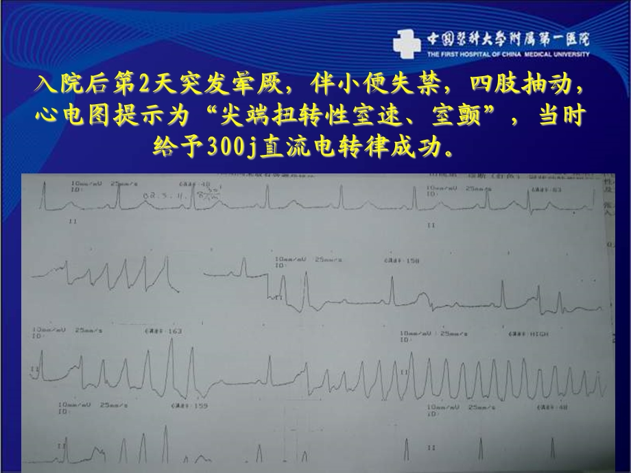 iii度房室传导阻滞及获得性长qt心衰患者起搏器升级治疗选择与疑惑程颖文档资料.ppt_第3页