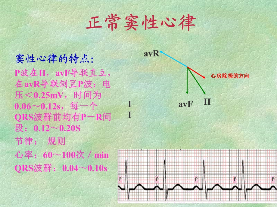 [所有分类]恶性心律失常的识别与护理PPT文档.ppt_第3页