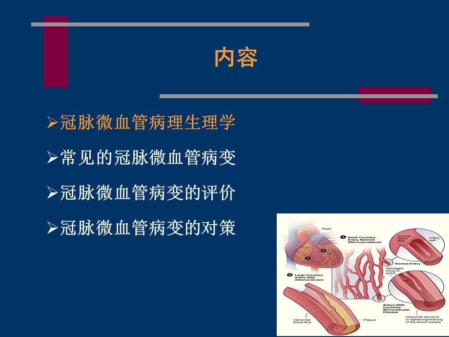 冠状动脉微血管病变和对策.ppt_第2页