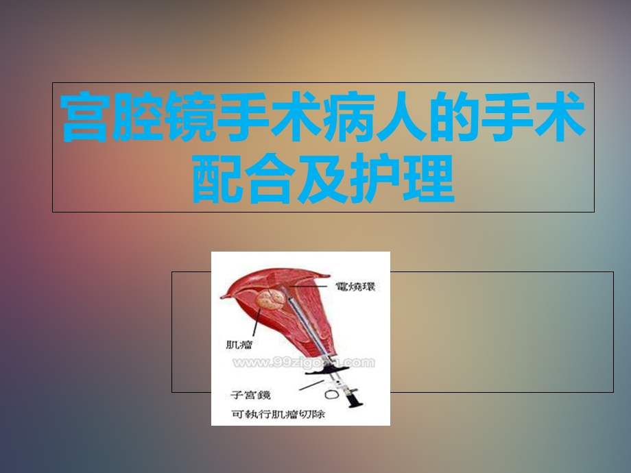 宫腔镜手术病人的手术配合及护理.ppt_第1页