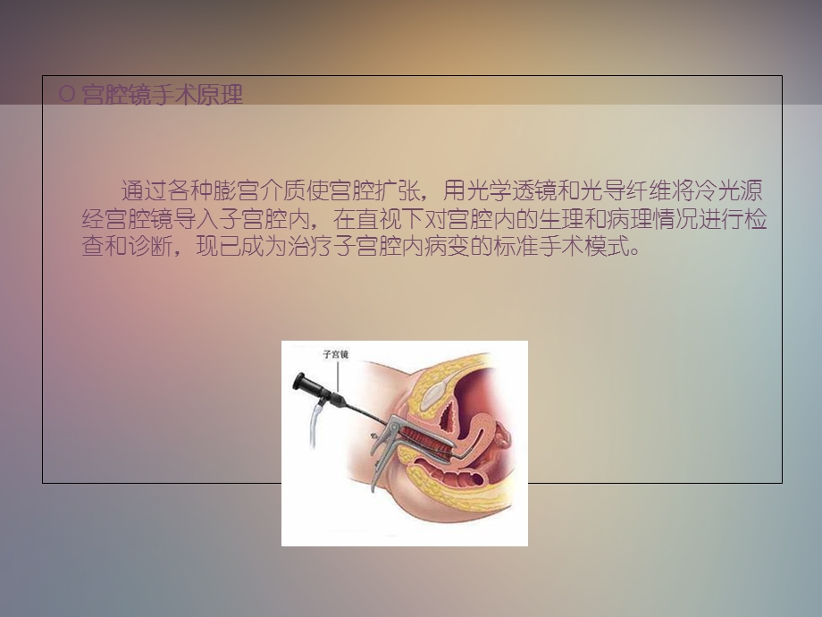 宫腔镜手术病人的手术配合及护理.ppt_第2页