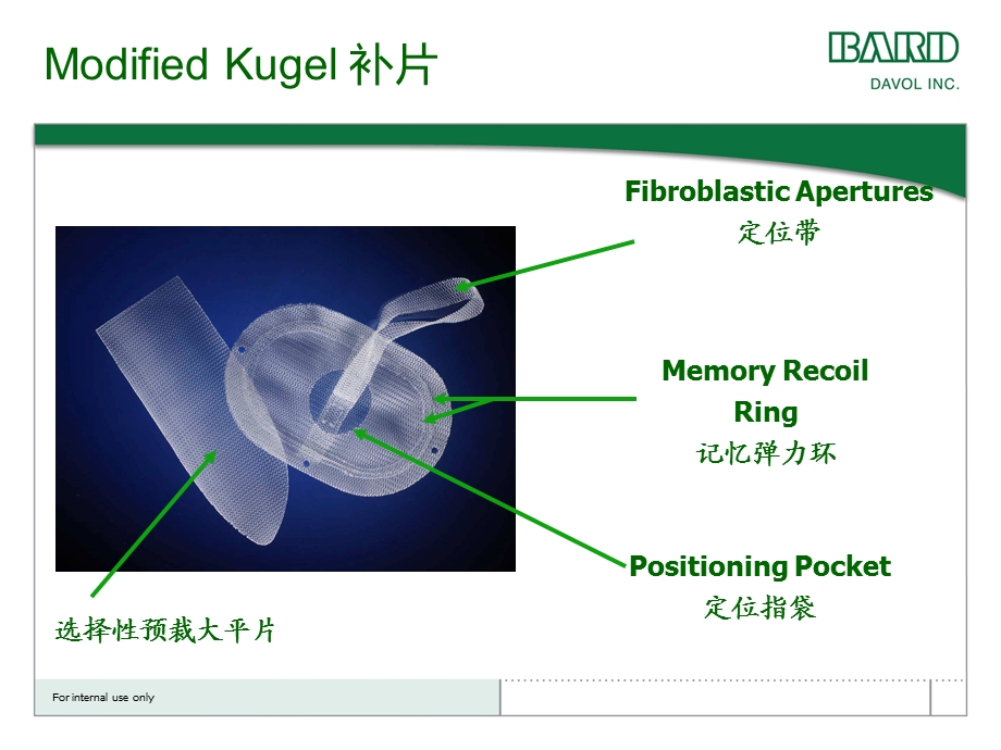 改良MK腹膜间隙术式文档资料.ppt_第1页