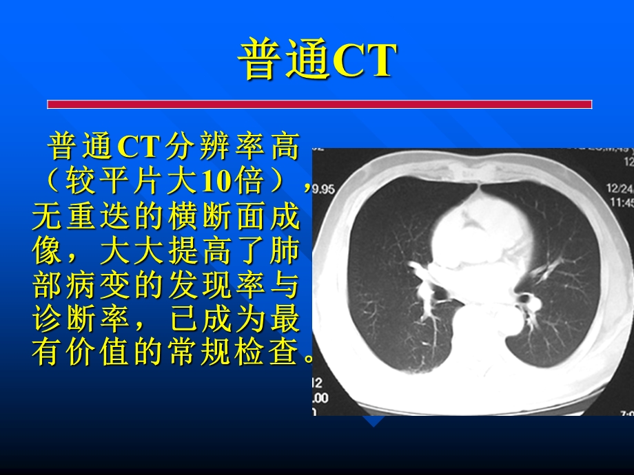 胸部各种影像学检查常见病的CT诊断.ppt_第2页