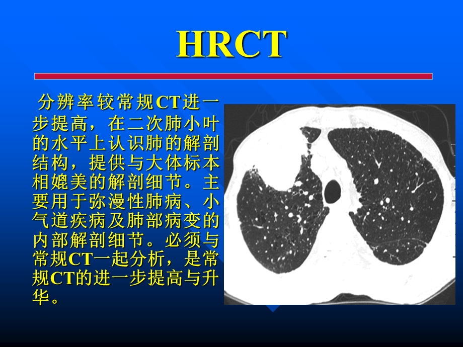 胸部各种影像学检查常见病的CT诊断.ppt_第3页