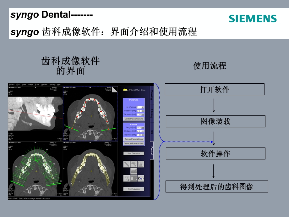 齿科成像软件Dental.ppt_第2页