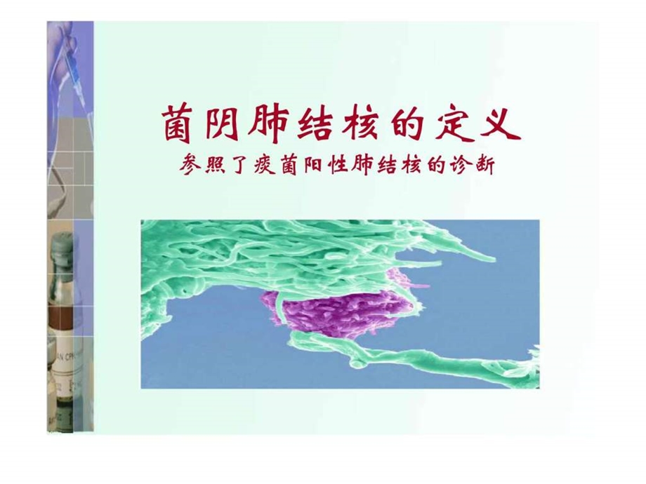 菌阴肺结核的诊断与治疗.ppt.ppt_第2页