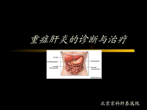 重症肝炎的诊断与治疗北京肝病医院图文.ppt.ppt