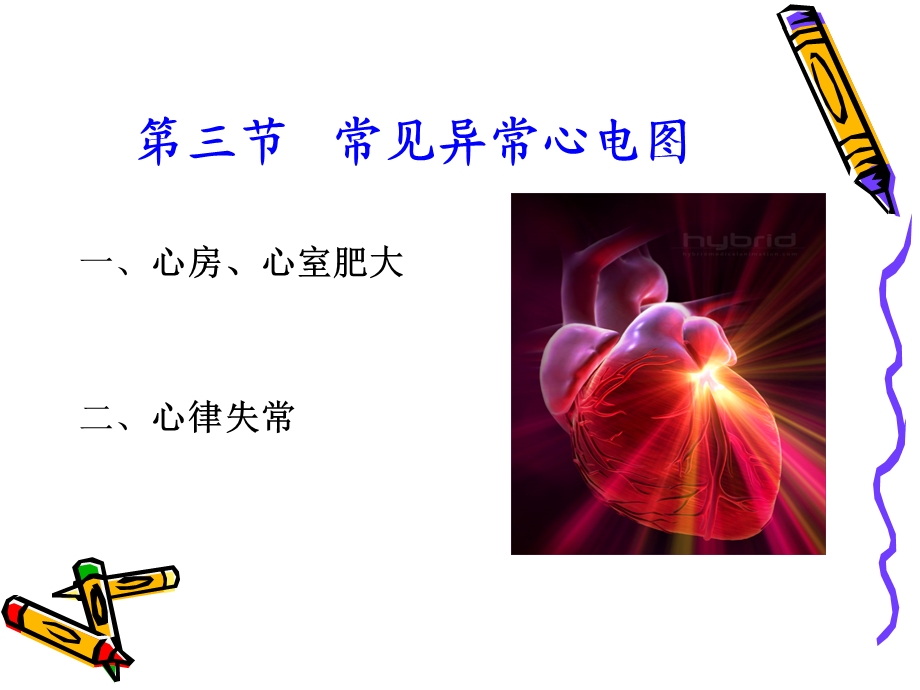 常见异常心电图.ppt_第2页