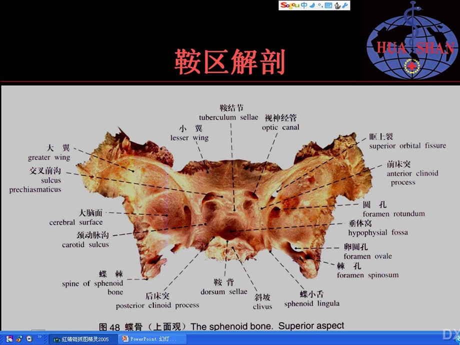 鞍区病变影像诊断-(上).ppt_第2页