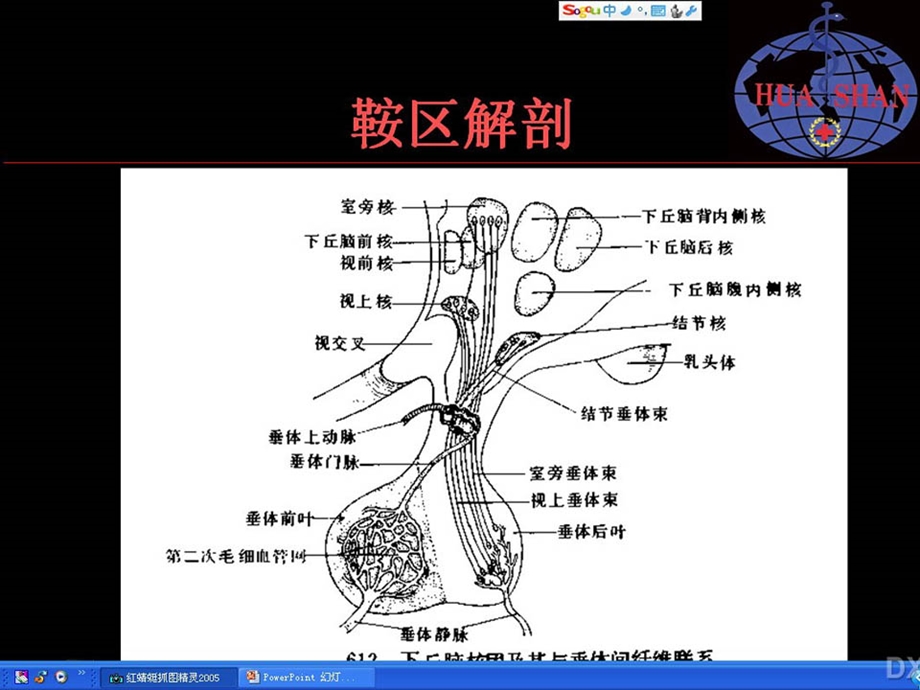 鞍区病变影像诊断-(上).ppt_第3页