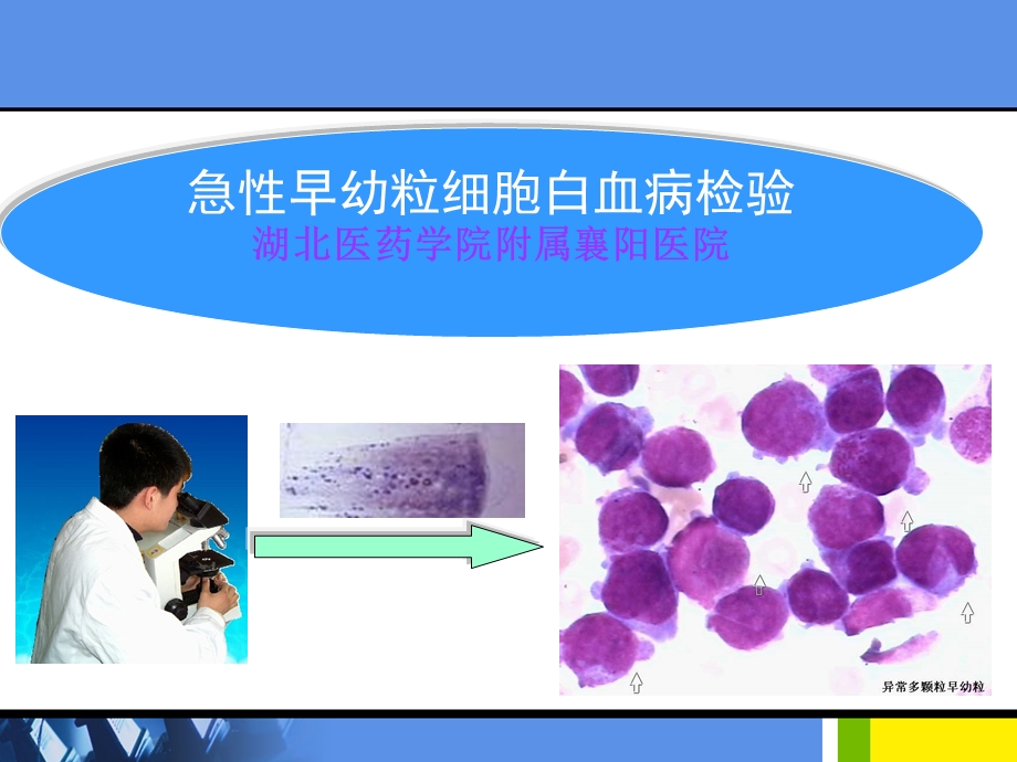 急性早幼粒细胞白血病的检验.ppt_第1页