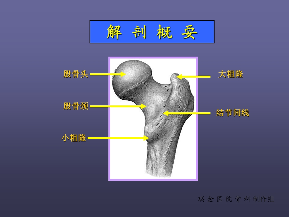 股骨颈骨折PPT.ppt_第3页