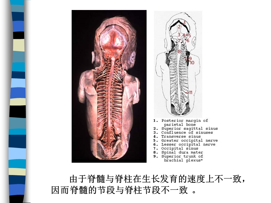 脊髓病基础知识.ppt_第3页