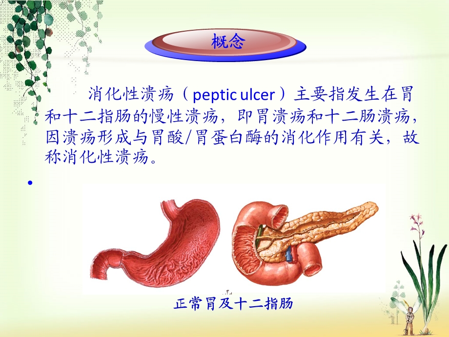 消化系统消化性溃疡护理业务学习.ppt_第3页