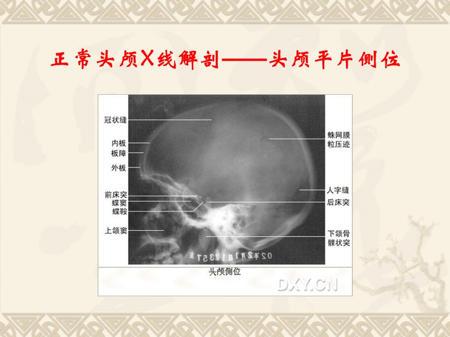 正常解剖X线影像学课件.ppt_第2页