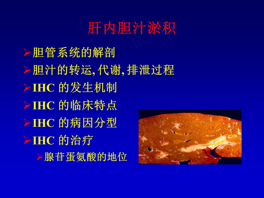 肝内胆汁淤积-武汉.ppt_第2页