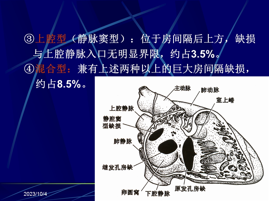 超声诊断学一先天性心脏病影像学课件.ppt_第3页