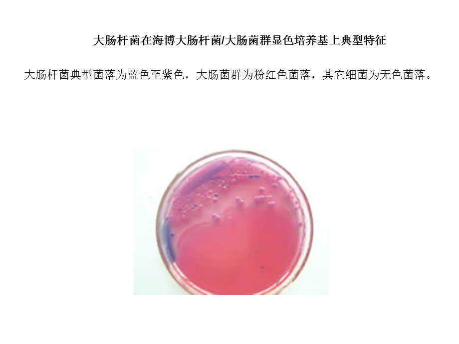 金黄色葡萄球菌在BP琼脂上典型特征.ppt_第3页