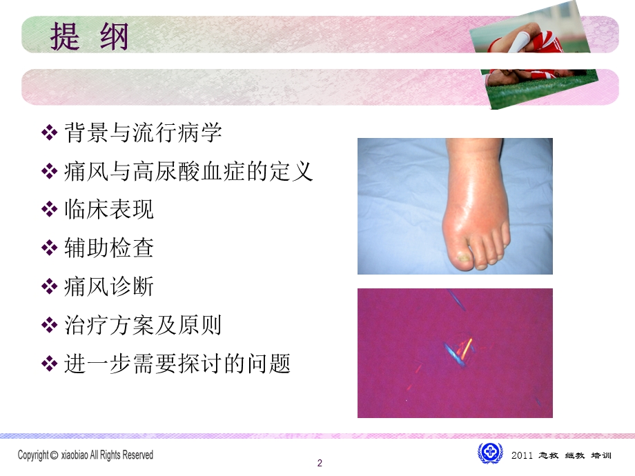 年中国痛风临床诊治指南解读.ppt_第2页