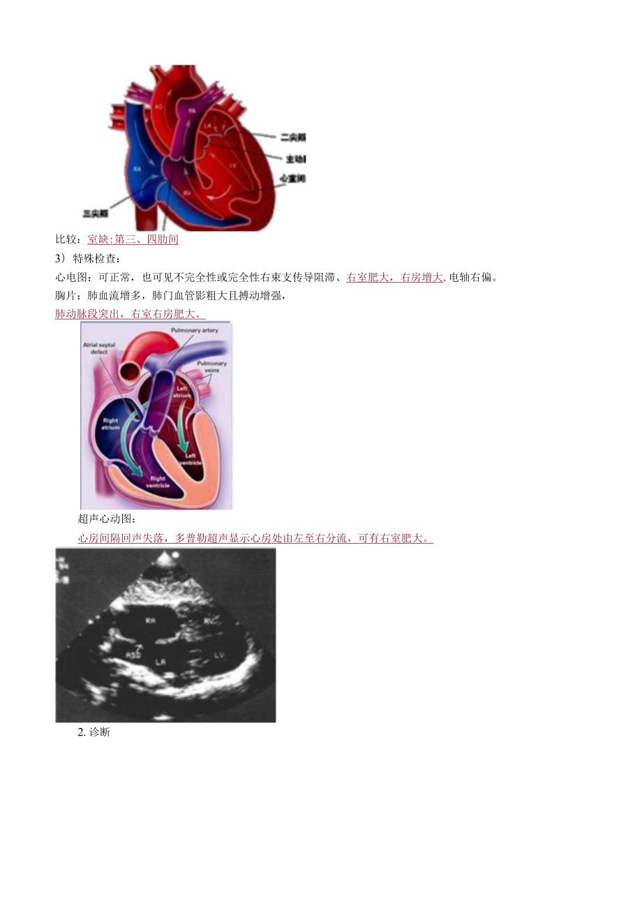 心血管内科主治医师资格笔试专业知识考点解析 (4)：先天性心血管病.docx_第3页