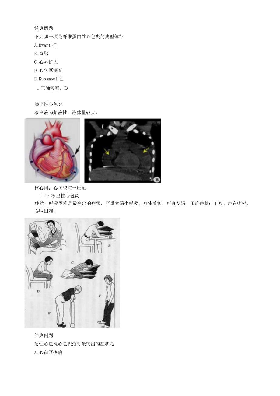 心血管内科主治医师资格笔试专业知识考点解析 (10)：心包炎.docx_第2页