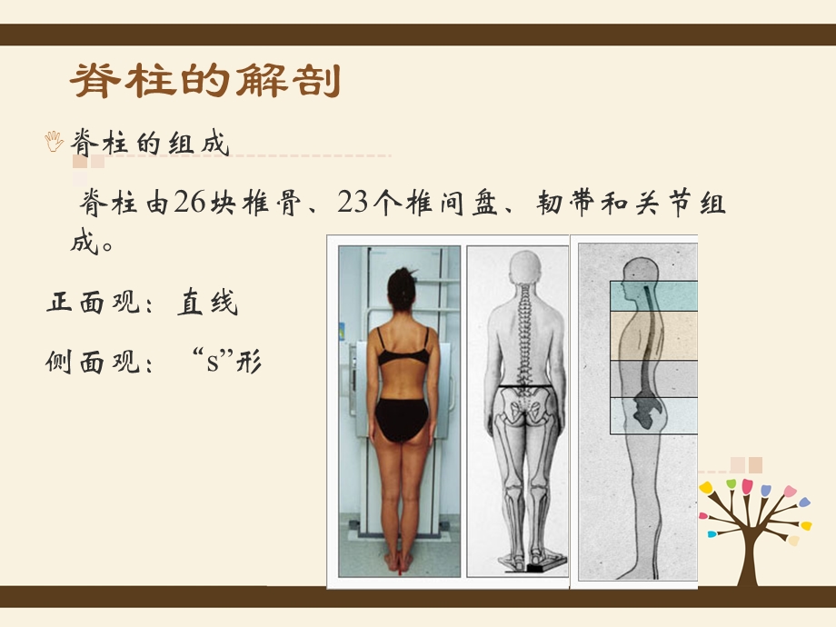 脊柱侧弯护理查房.ppt_第2页